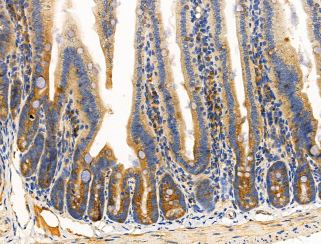 ACTA1 Antibody in Immunohistochemistry (Paraffin) (IHC (P))