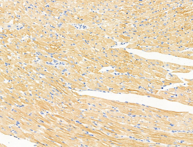 ACTA1 Antibody in Immunohistochemistry (Paraffin) (IHC (P))