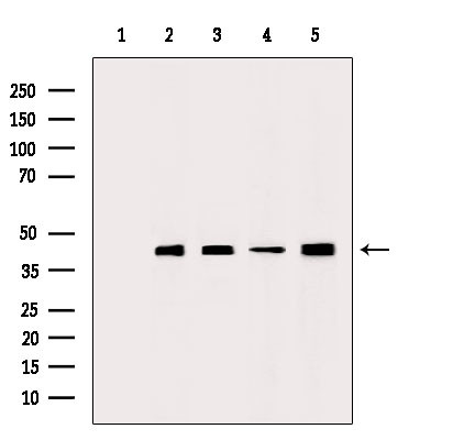 ACTA1 Antibody in Western Blot (WB)