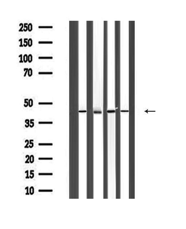 ACTA1 Antibody in Western Blot (WB)