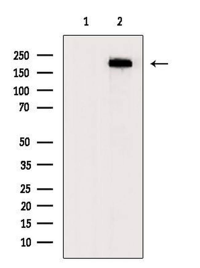 Fibronectin Antibody in Western Blot (WB)