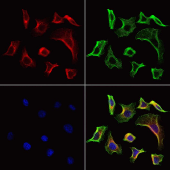 FAP Antibody in Immunocytochemistry (ICC/IF)