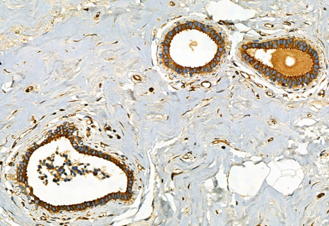 FAP Antibody in Immunohistochemistry (Paraffin) (IHC (P))