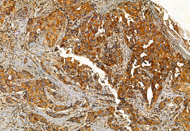 FAP Antibody in Immunohistochemistry (Paraffin) (IHC (P))