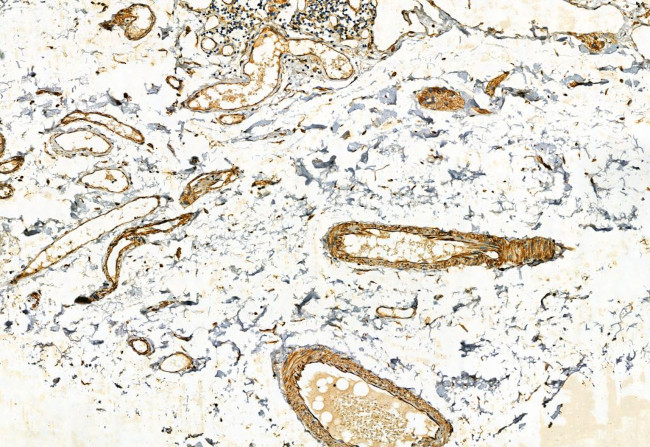 FAP Antibody in Immunohistochemistry (Paraffin) (IHC (P))