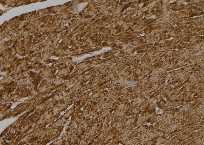 Caspase 6 (Cleaved Asp179) Antibody in Immunohistochemistry (Paraffin) (IHC (P))