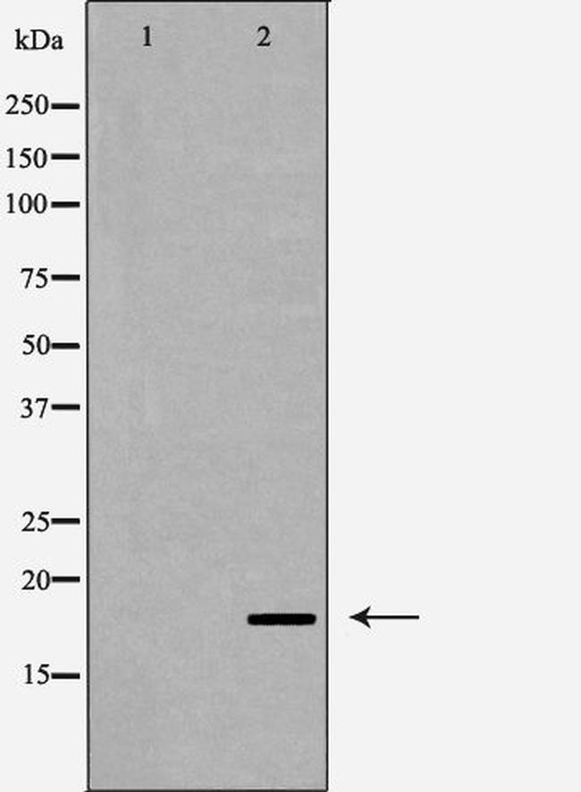 Caspase 6 (Cleaved Asp179) Antibody in Western Blot (WB)