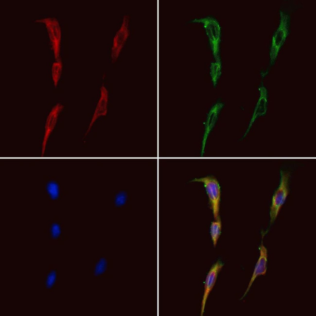 BMPR2 Antibody in Immunocytochemistry (ICC/IF)