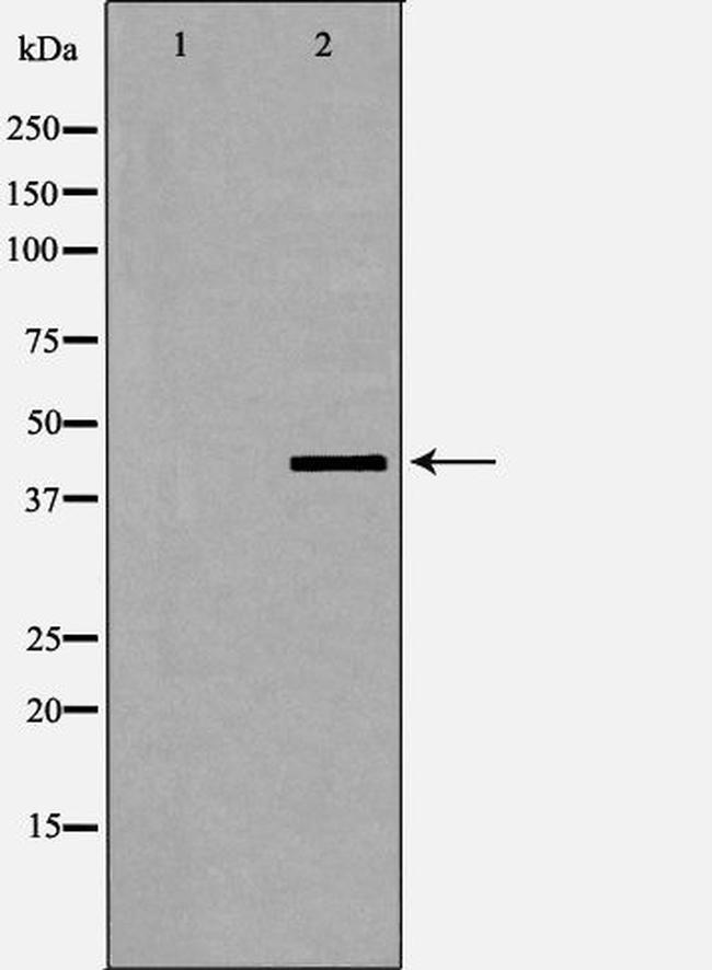 Phospho-Dematin (Ser403) Antibody in Western Blot (WB)