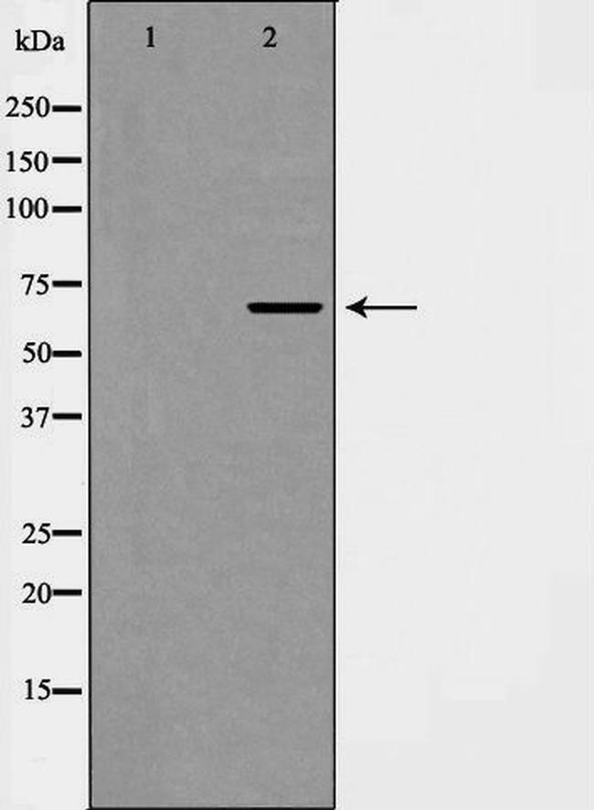 Phospho-EIF4B (Ser422) Antibody in Western Blot (WB)