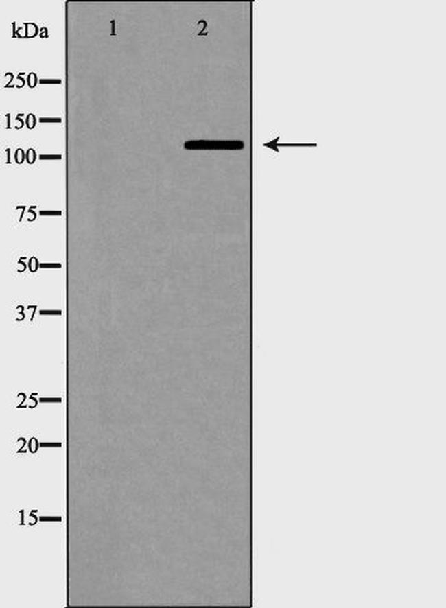 Phospho-TERT (Ser824) Antibody in Western Blot (WB)