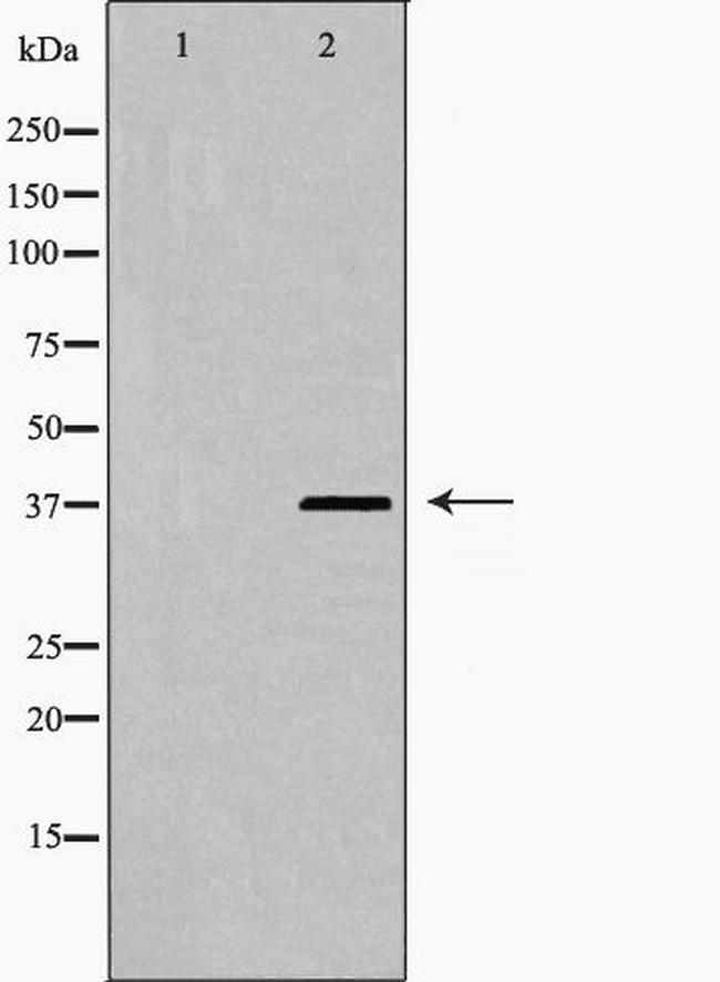 Phospho-hnRNP D (Ser83) Antibody in Western Blot (WB)