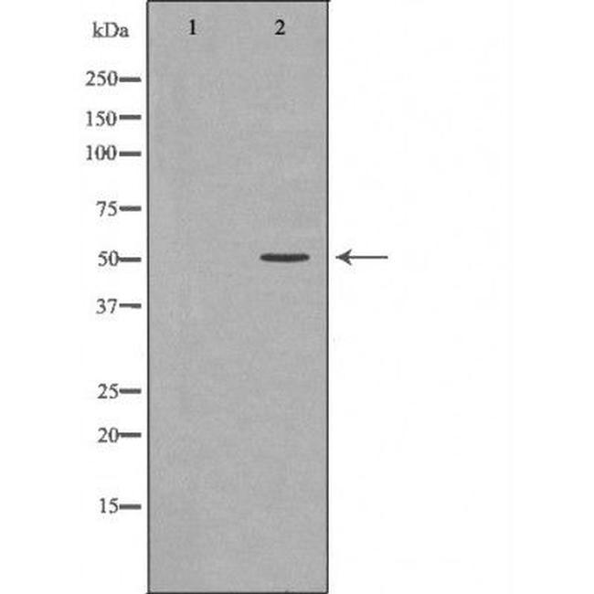 Phospho-hnRNP K (Ser284) Antibody in Western Blot (WB)