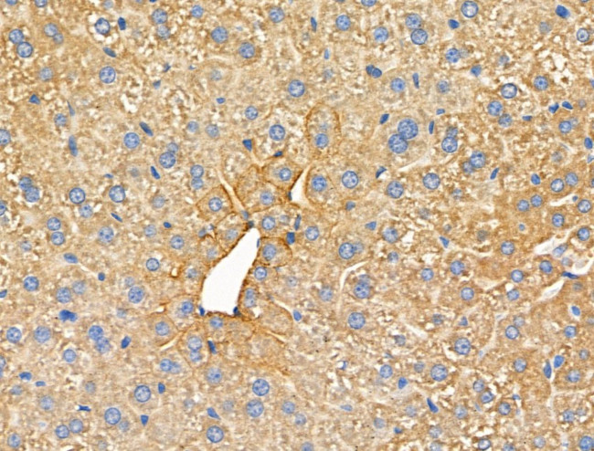 RhoH Antibody in Immunohistochemistry (Paraffin) (IHC (P))