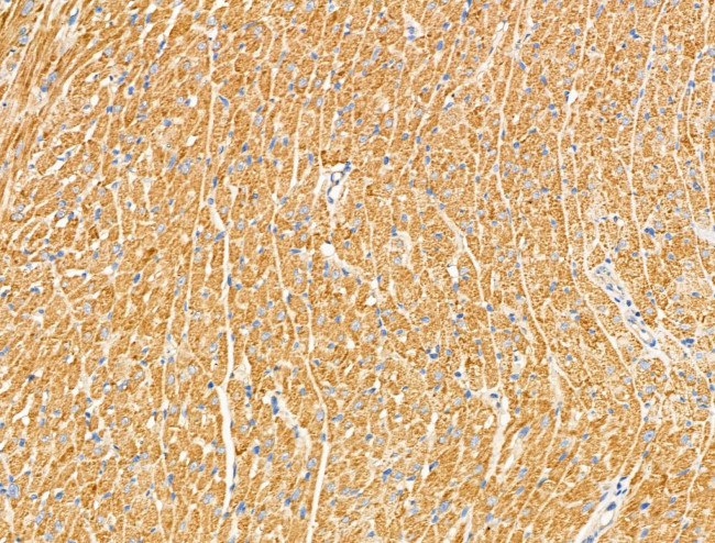 RhoH Antibody in Immunohistochemistry (Paraffin) (IHC (P))