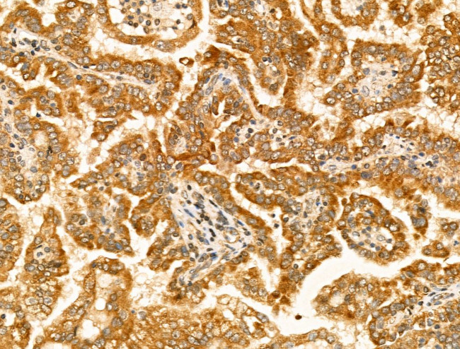 Tyrosinase Antibody in Immunohistochemistry (Paraffin) (IHC (P))