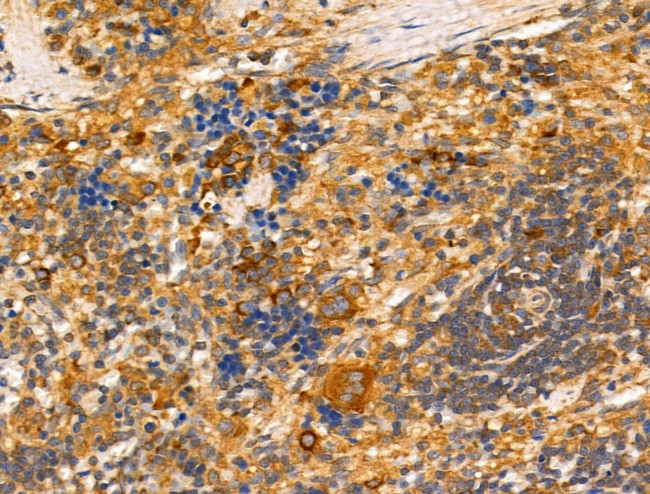 Tyrosinase Antibody in Immunohistochemistry (Paraffin) (IHC (P))