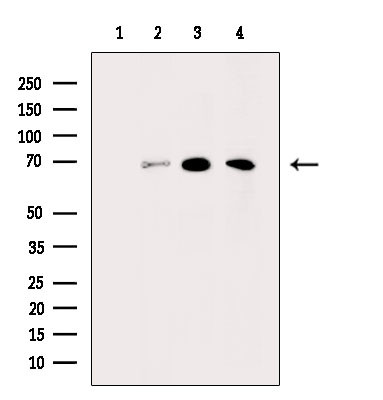 Tyrosinase Antibody in Western Blot (WB)