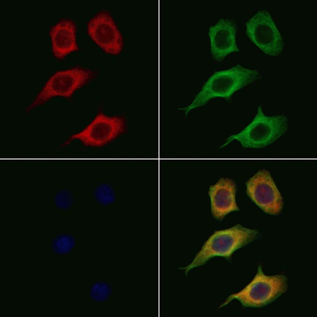 Tyrosinase Antibody in Immunocytochemistry (ICC/IF)