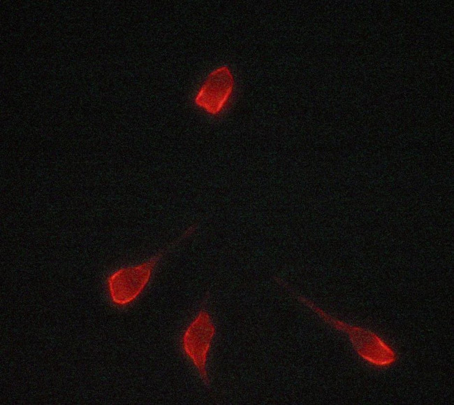 Tyrosinase Antibody in Immunocytochemistry (ICC/IF)