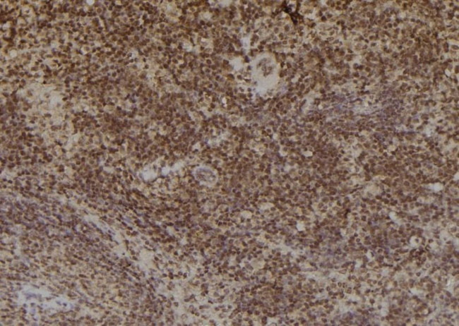 Tyrosinase Antibody in Immunohistochemistry (Paraffin) (IHC (P))