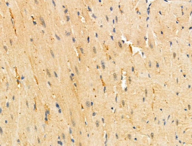 TNFAIP6 Antibody in Immunohistochemistry (Paraffin) (IHC (P))