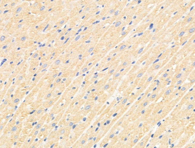 TNFAIP6 Antibody in Immunohistochemistry (Paraffin) (IHC (P))