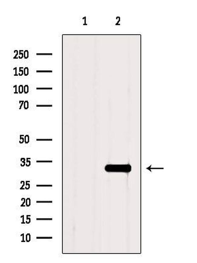 TNFAIP6 Antibody in Western Blot (WB)