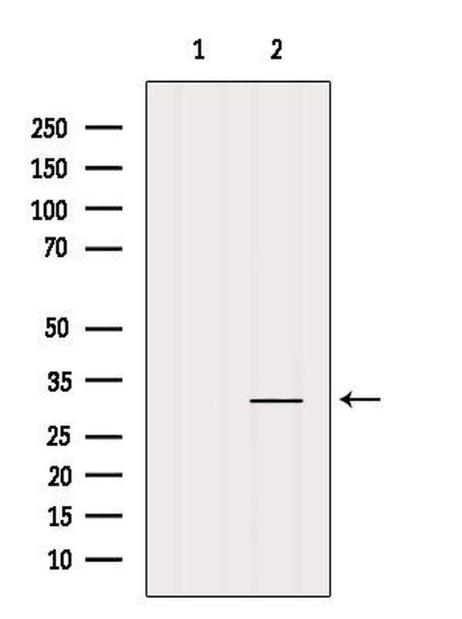 TNFAIP6 Antibody in Western Blot (WB)