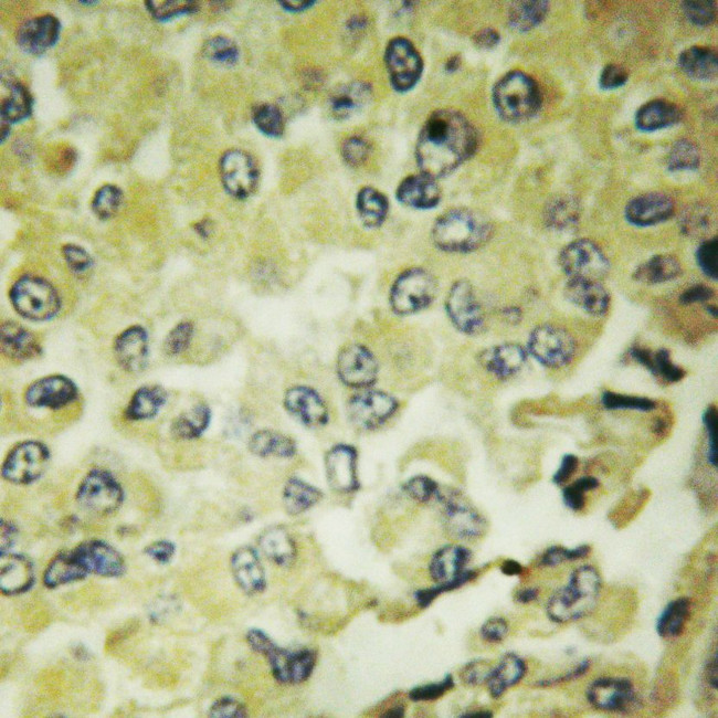 IkB epsilon Antibody in Immunohistochemistry (Paraffin) (IHC (P))