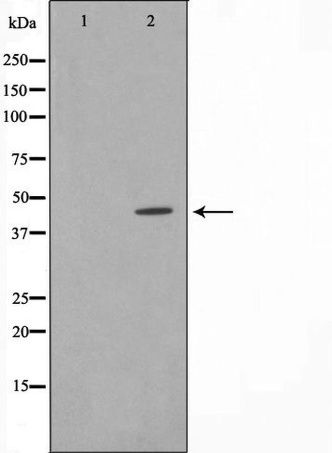 IkB epsilon Antibody in Western Blot (WB)