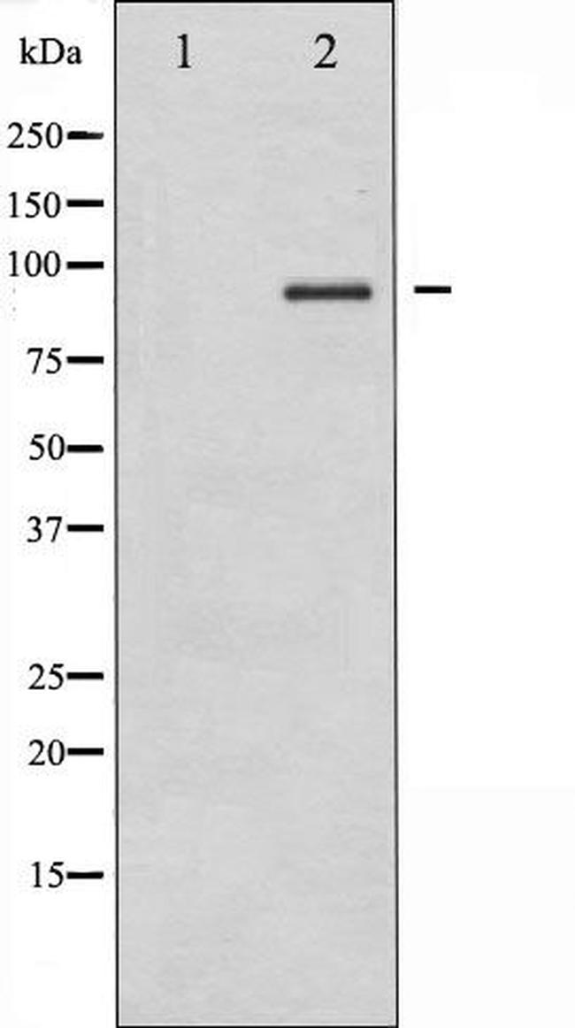 IKK alpha/beta Antibody in Western Blot (WB)