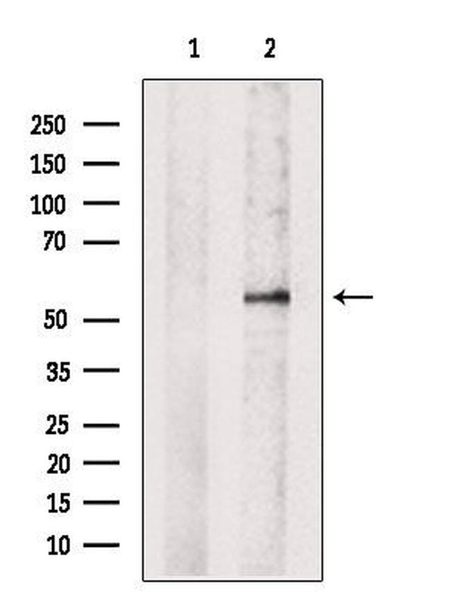 DOK2 Antibody in Western Blot (WB)