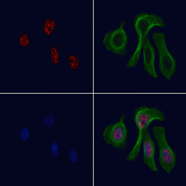 RB1 Antibody in Immunocytochemistry (ICC/IF)