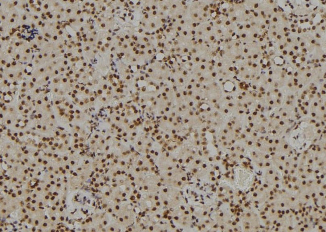 RB1 Antibody in Immunohistochemistry (Paraffin) (IHC (P))