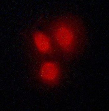 VDR Antibody in Immunocytochemistry (ICC/IF)