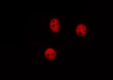 RPA32 Antibody in Immunocytochemistry (ICC/IF)