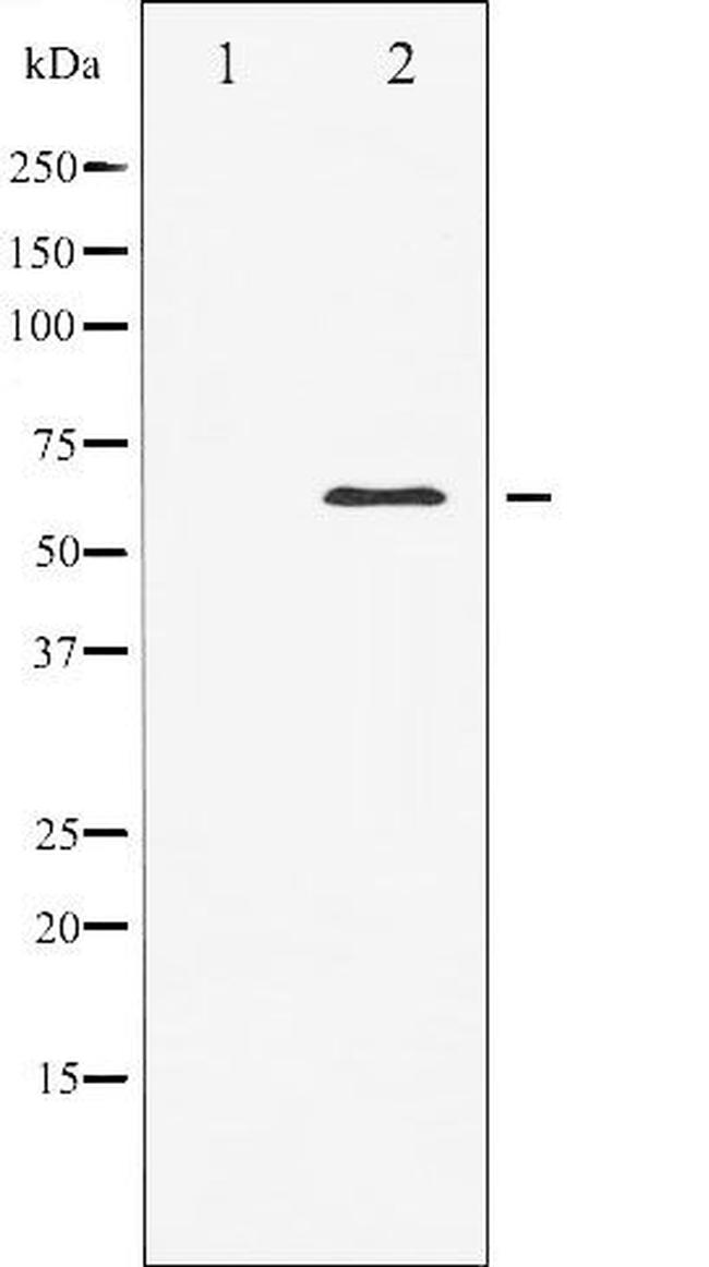 Elk1 Antibody in Western Blot (WB)