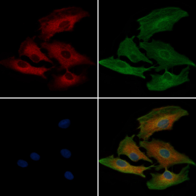 Filamin A Antibody in Immunocytochemistry (ICC/IF)