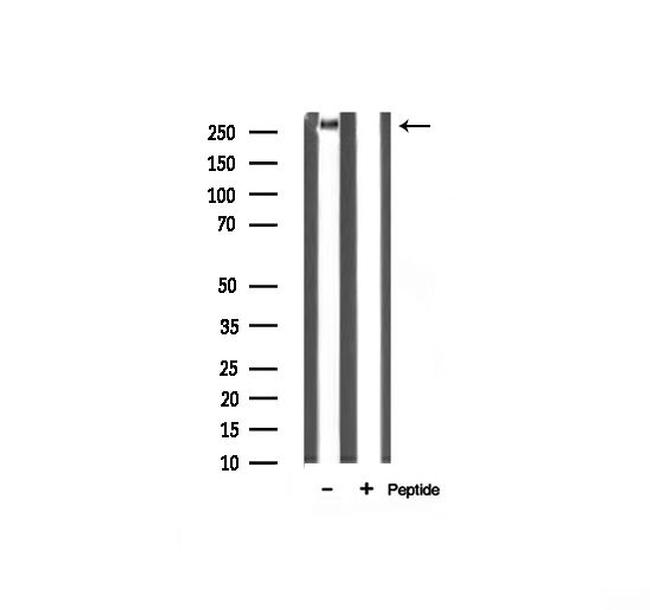 Filamin A Antibody in Western Blot (WB)