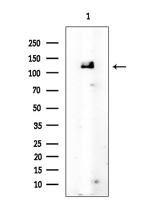 c-Cbl Antibody in Western Blot (WB)