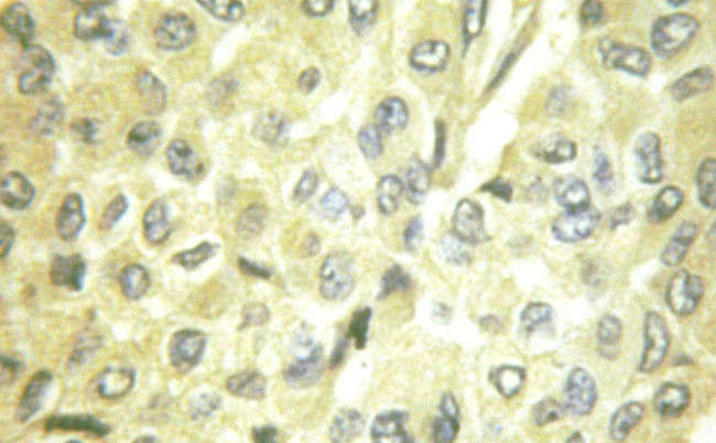 PI3K p85/p55 Antibody in Immunohistochemistry (Paraffin) (IHC (P))