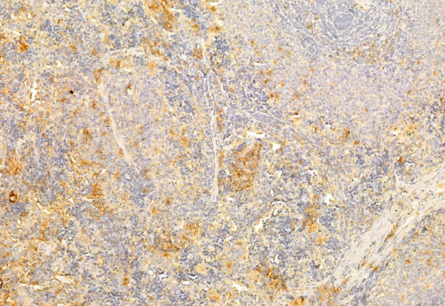 PI3K p85/p55 Antibody in Immunohistochemistry (Paraffin) (IHC (P))