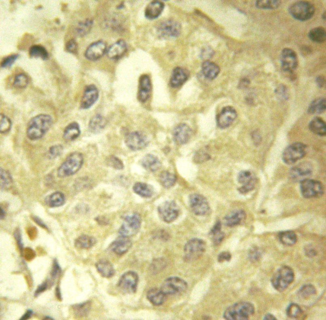 SHC Antibody in Immunohistochemistry (Paraffin) (IHC (P))