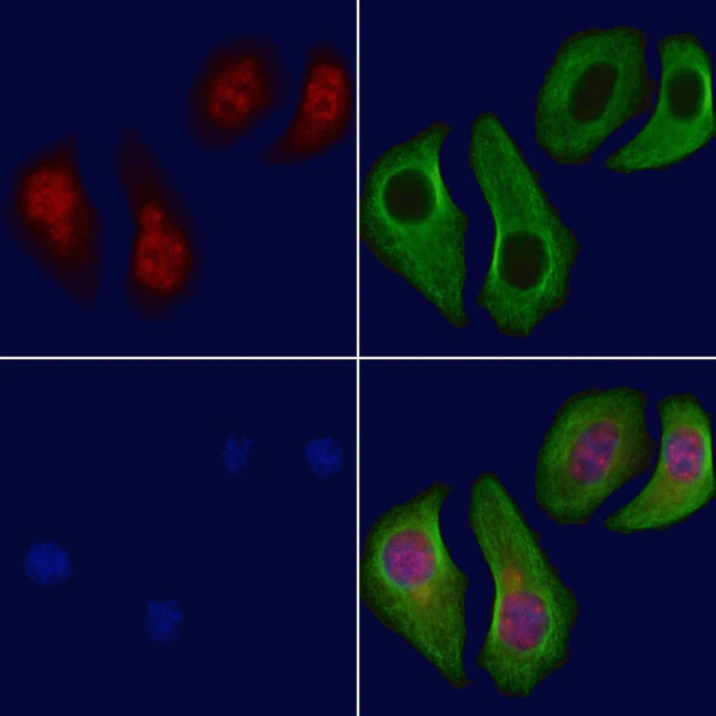 BRCA1 Antibody in Immunocytochemistry (ICC/IF)