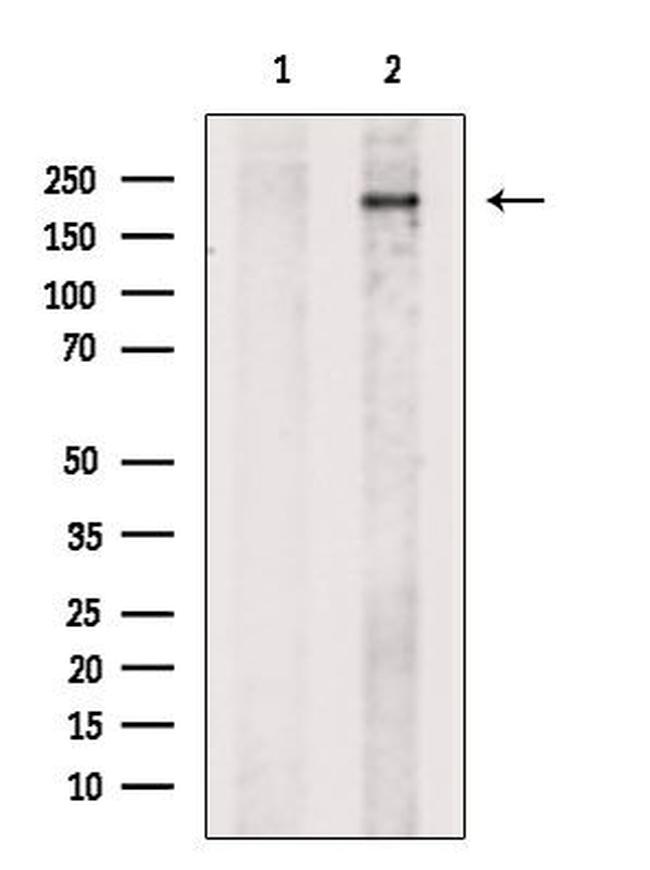 BRCA1 Antibody in Western Blot (WB)