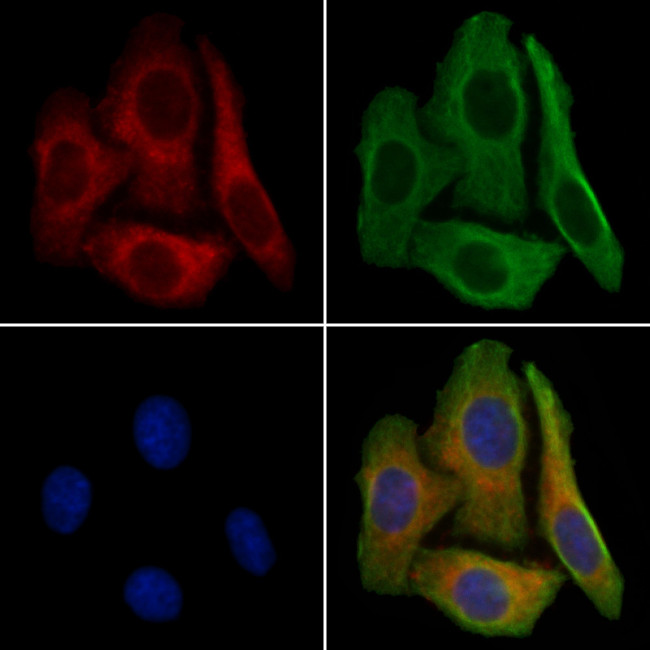 GluR1 Antibody in Immunocytochemistry (ICC/IF)