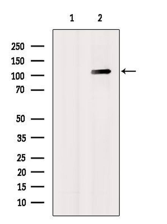 GluR1 Antibody in Western Blot (WB)