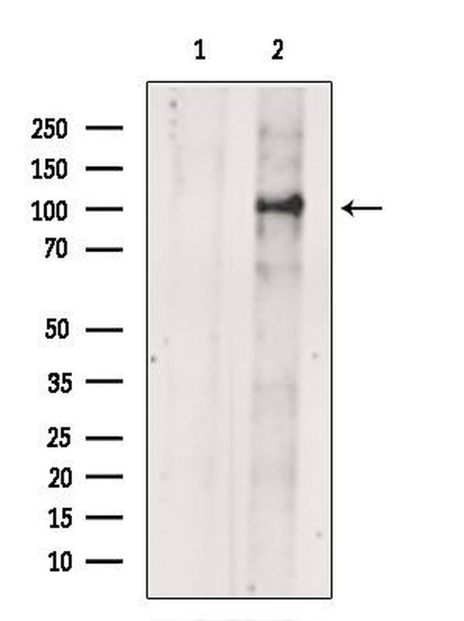 GluR1 Antibody in Western Blot (WB)