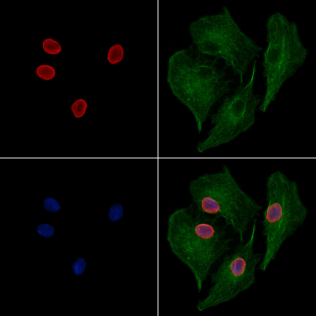 JNK1/JNK2/JNK3 Antibody in Immunocytochemistry (ICC/IF)